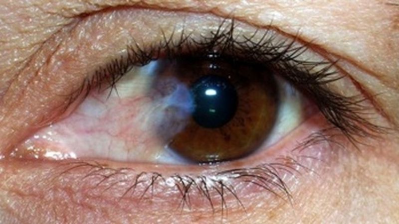 Võng mạc: một lớp mô thần kinh quan trọng trong mắt