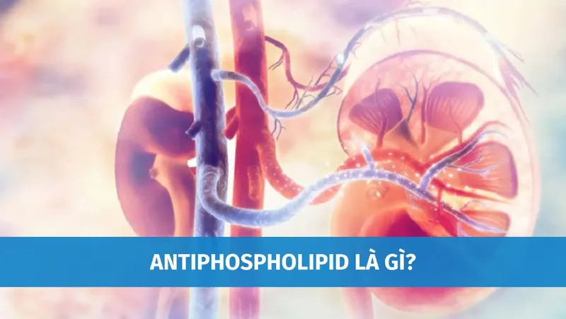 Anti phospholipid igm là gì? tìm hiểu về loại xét nghiệm quan trọng cho phụ nữ mang thai