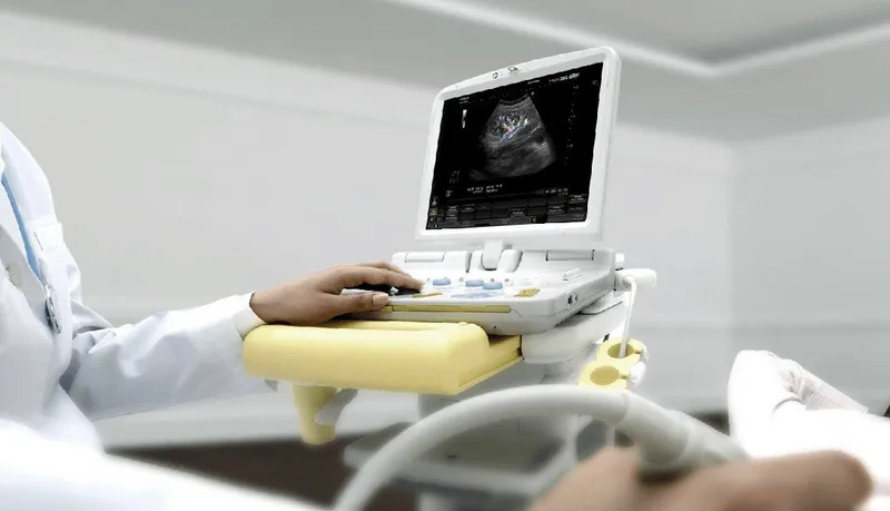Siêu âm tuyến thượng thận: một phương pháp quan trọng trong y học