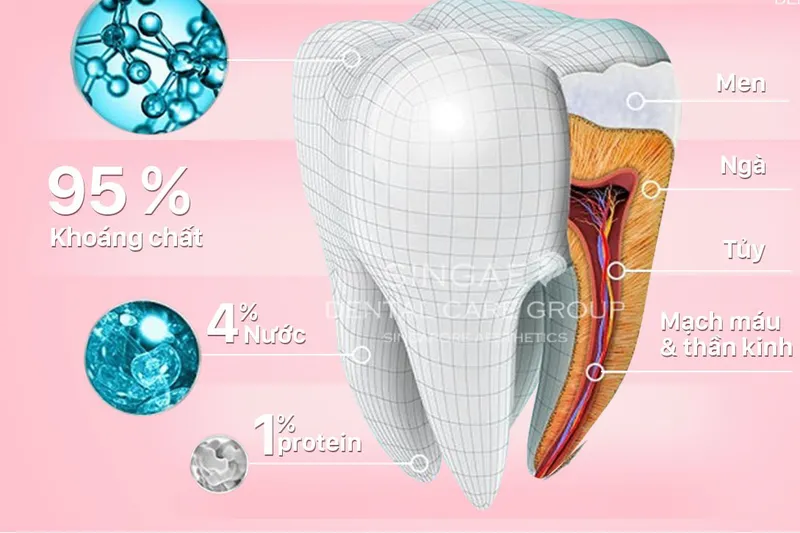 Hỏng men răng: khám phá, nguyên nhân, triệu chứng và cách xử lý