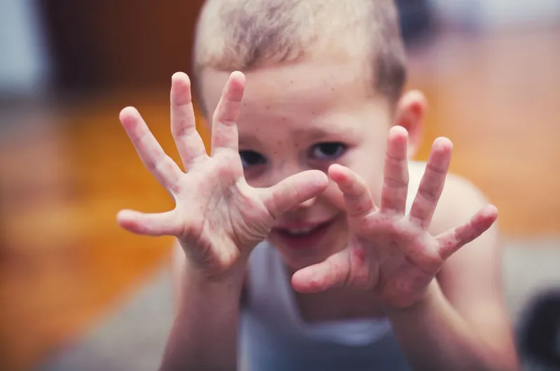 Nhấn vào ảnh để phóng to Phòng chống bệnh tay chân miệng: cách đơn giản, hiệu quả