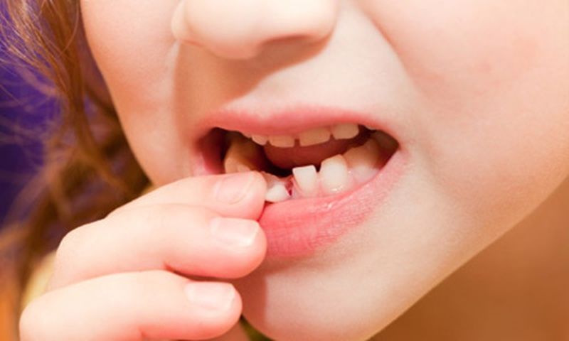 Sự thay thế răng sữa bằng răng vĩnh viễn: quy luật không thể tránh