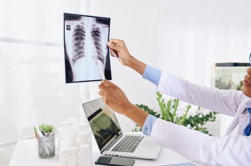 Chấn thương phần mềm xương sườn: nguyên nhân, triệu chứng và cách điều trị