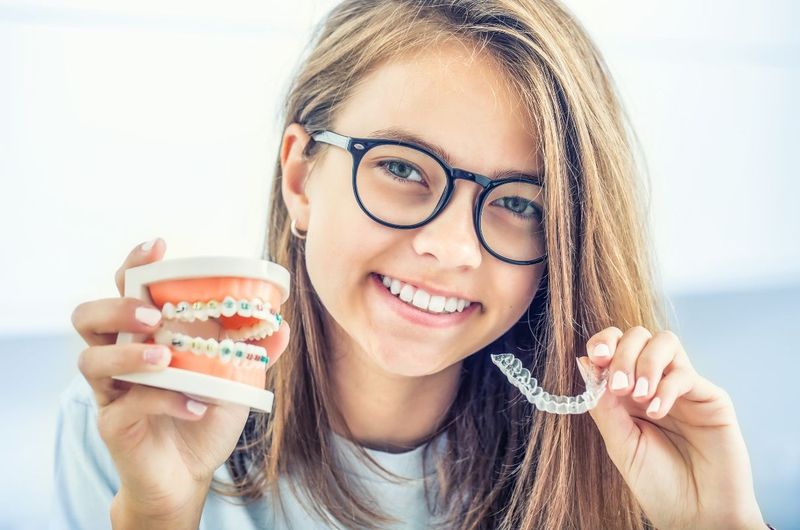 Tuổi 25 có thể niềng răng được không?