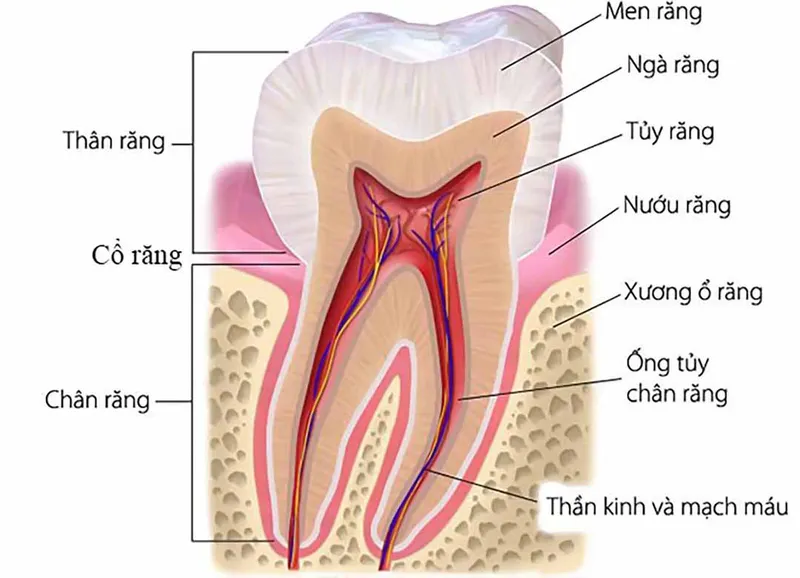 Trám bít hố rãnh: phương pháp phòng ngừa sâu răng hiệu quả cho trẻ em