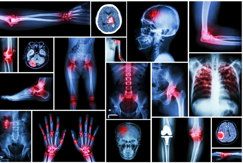 Đa chấn thương: tình trạng nguy hiểm và cách xử trí