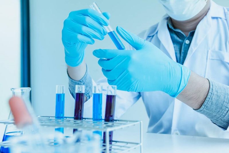 Ivd: công nghệ chẩn đoán ngoại vi là gì và các loại phổ biến