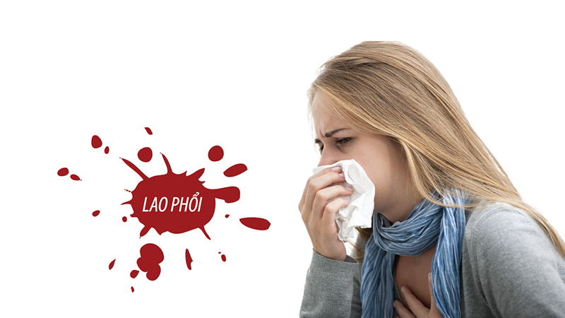 Tiêm phòng lao - phương pháp hiệu quả để ngăn chặn căn bệnh nguy hiểm này