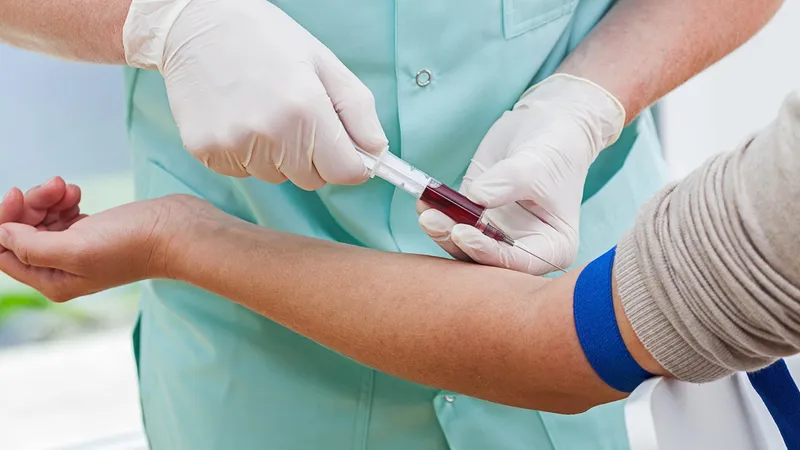 Xét nghiệm đo độ thẩm thấu máu: khái niệm và ý nghĩa