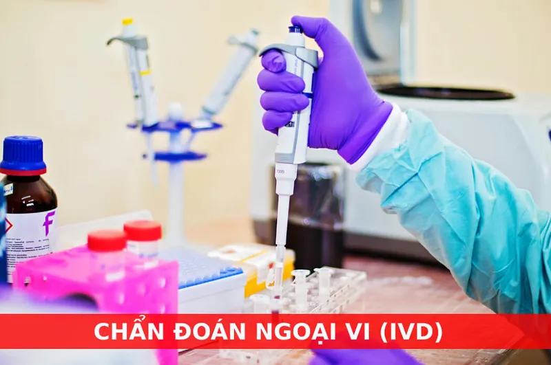 Ivd: công nghệ chẩn đoán ngoại vi là gì và các loại phổ biến