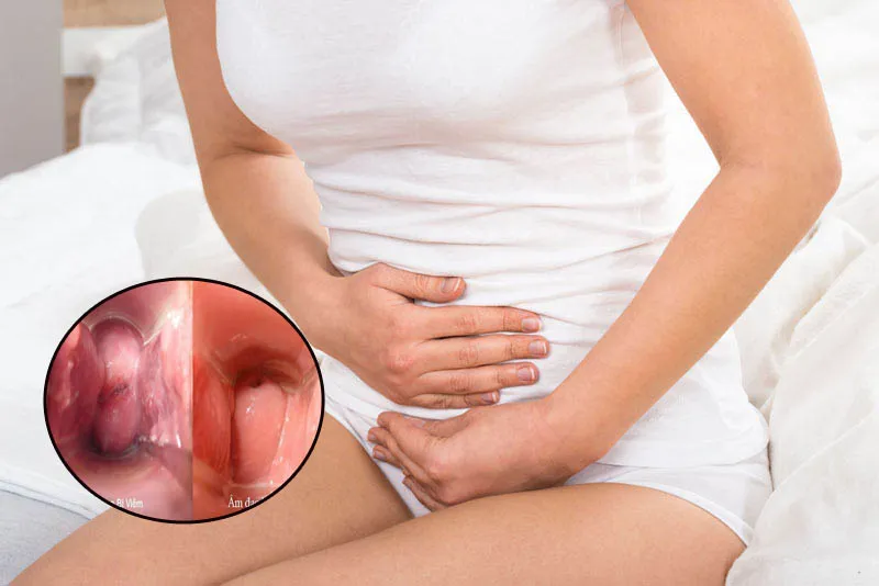 Có nên lo khi ra nhiều khí hư loãng như nước khi mang thai?