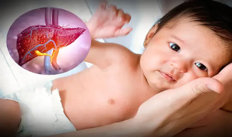 Gan to ở trẻ em: nguyên nhân, triệu chứng và cách chẩn đoán