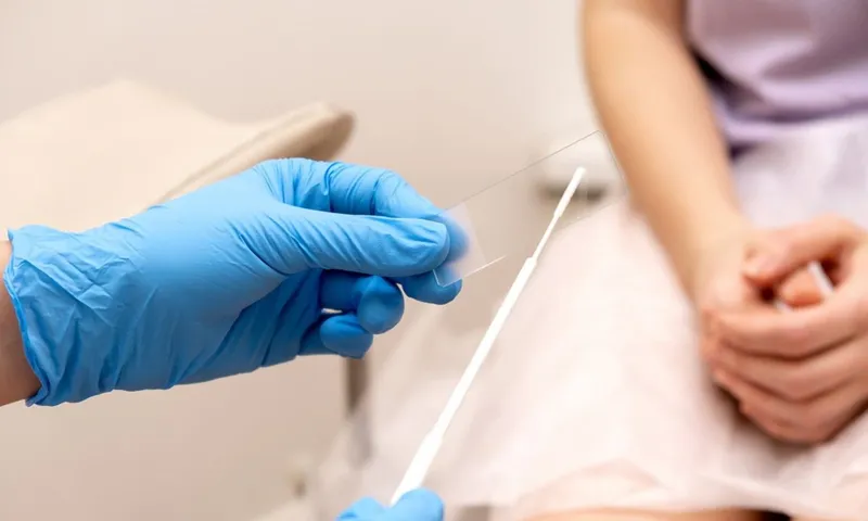 Lậu – bệnh xã hội nguy hiểm có thể lây truyền qua hoạt động tình dục không an toàn