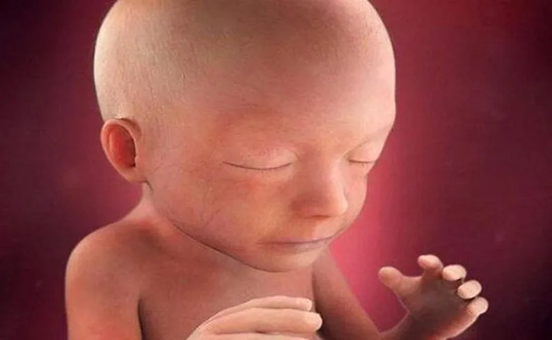 Đánh giá chiều dài xương sống mũi của thai nhi theo tuần - tìm hiểu về hội chứng down