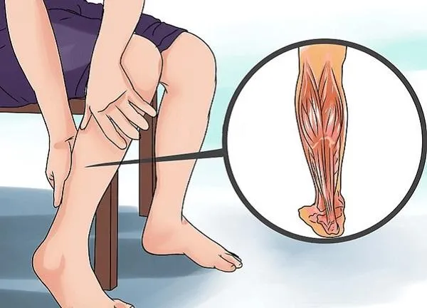 Tại sao co cơ là một vấn đề quan trọng và cần được chữa trị đúng cách?