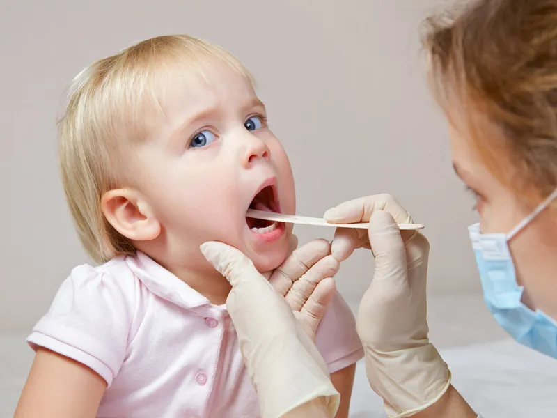 Viêm lợi trùm ở trẻ em: nguyên nhân và biện pháp xử lý