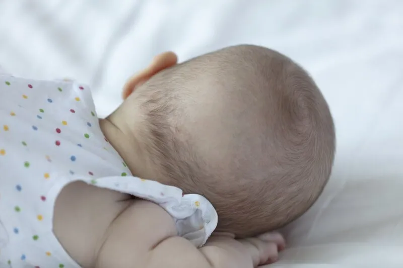 Tình trạng rụng tóc máu ở trẻ sơ sinh: có nên lo lắng?
