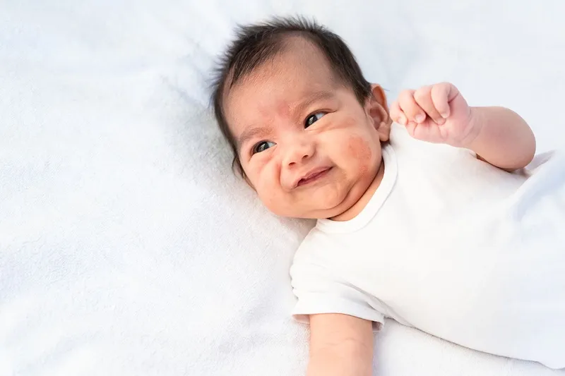 Cách trị chàm sữa bằng sữa mẹ: hiệu quả và đơn giản