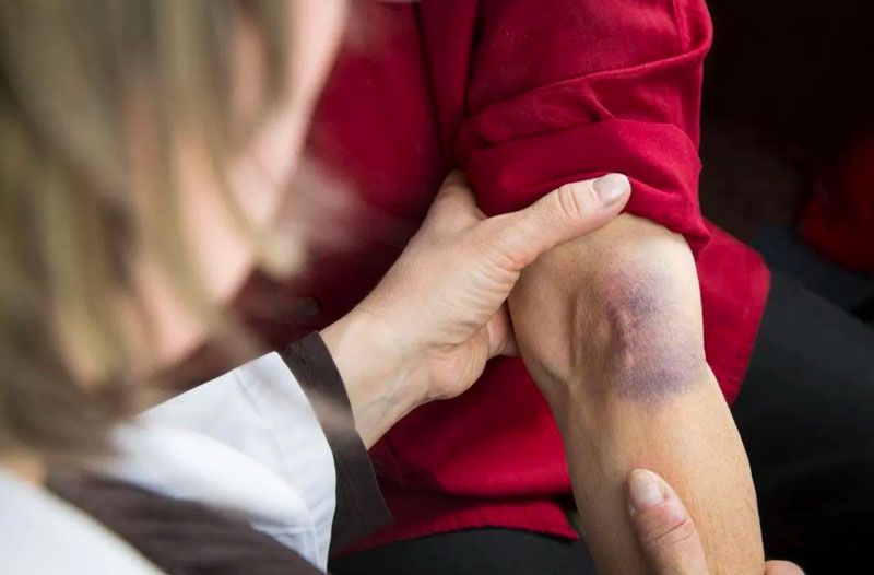 Tận dụng hiệu quả phương pháp hút dịch khớp cổ tay để chăm sóc sức khỏe