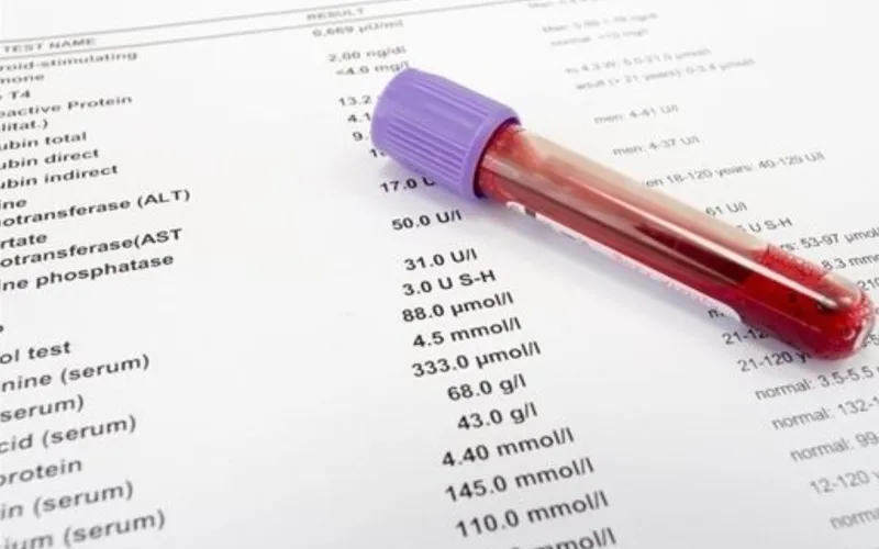 Xét nghiệm sắt trong máu: đánh giá và quan trọng trong chẩn đoán
