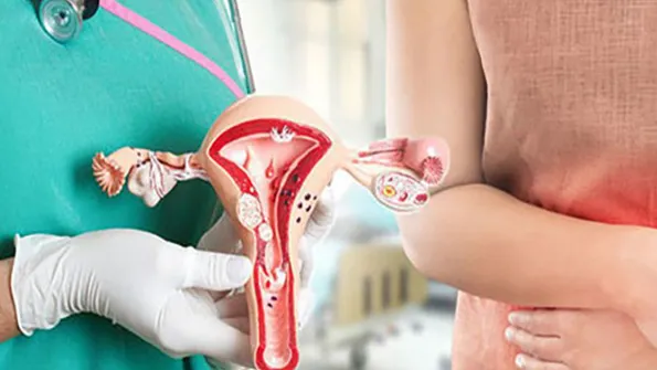 Tìm hiểu về phác đồ điều trị viêm lộ tuyến cổ tử cung