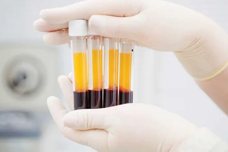 Hệ thống angiotensin aldosterone và vai trò của nó trong cơ thể