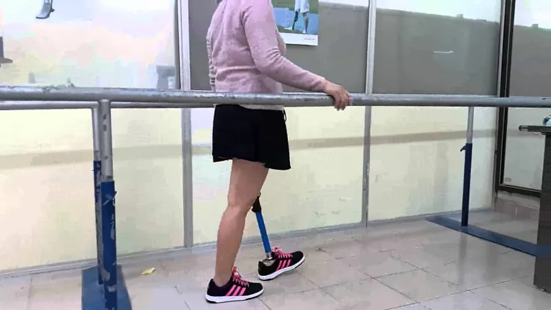 Lắp chân giả: chuẩn bị và quá trình lắp đặt