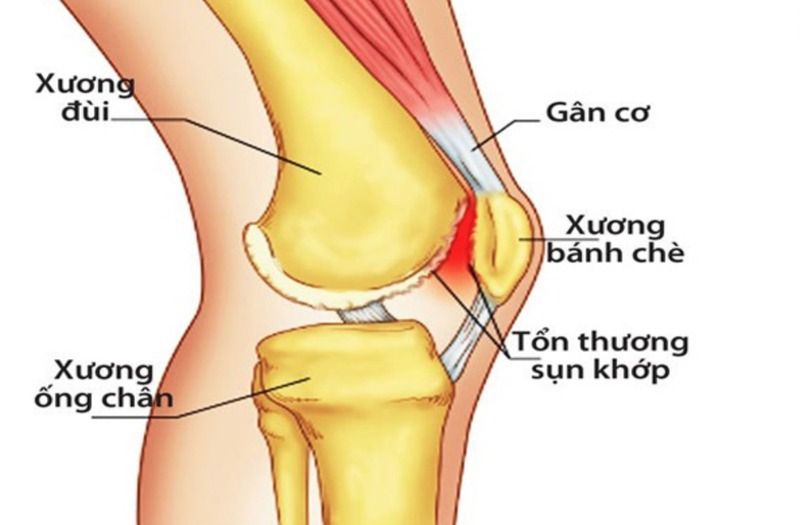 Đầu gối - cấu tạo và chức năng