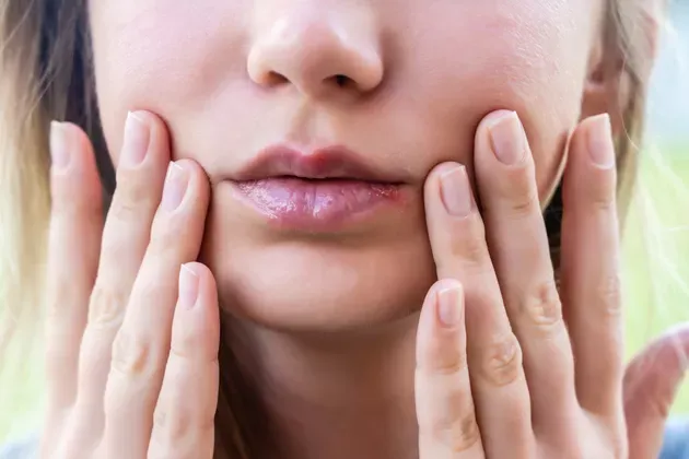 Phân biệt vết loét lạnh và mụn: những điểm khác biệt quan trọng