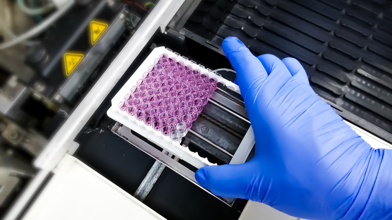 Lpa - line probe assay: phương pháp tiên tiến trong chẩn đoán bệnh nhiễm khuẩn và di truyền
