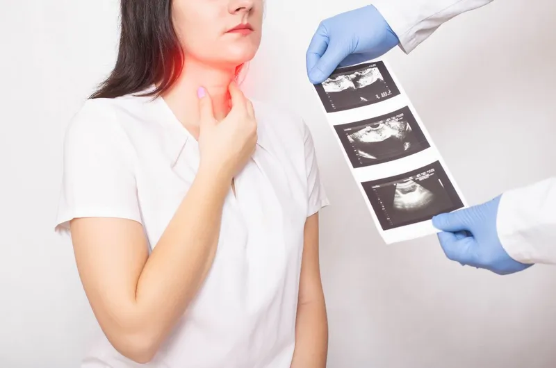 Bướu giáp là gì và cách chữa trị