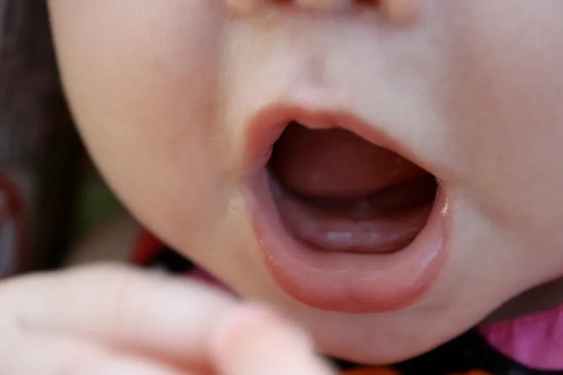 Trẻ 7 tháng chưa mọc răng, liệu có phải là triệu chứng bất thường?