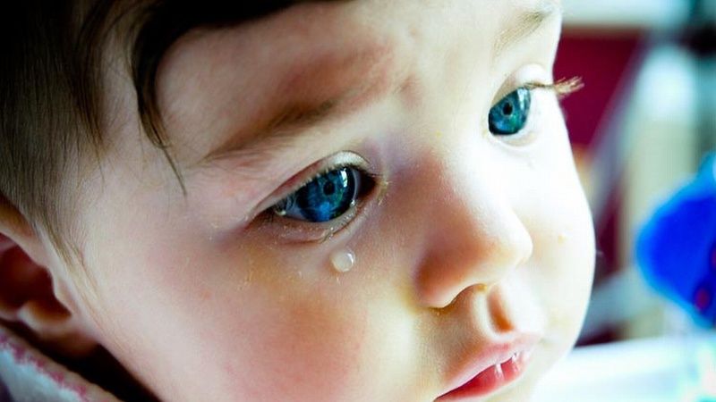 Bệnh cườm nước ở trẻ em: nguy hiểm và cách điều trị