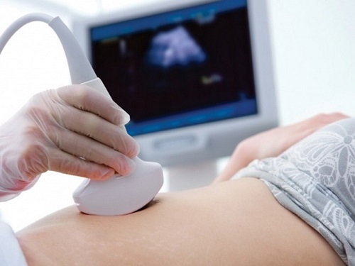 Bà bầu siêu âm nhiều có tốt không?