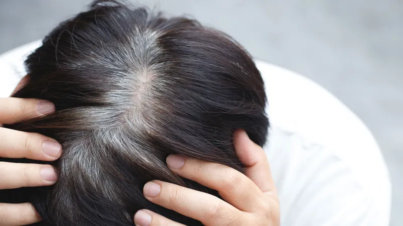 Trẻ em tóc bạc sớm khám ở đâu? những thông tin cần biết