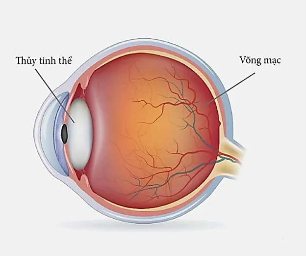 Thủy tinh thể: cấu trúc và vai trò quan trọng cho mắt của bạn