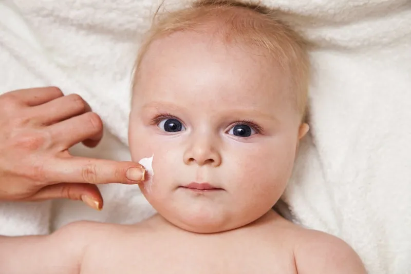 Dị ứng da mặt ở trẻ sơ sinh: triệu chứng và cách điều trị