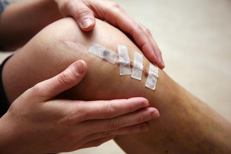 Rách sụn chêm có thể tiếp tục đá bóng được không?