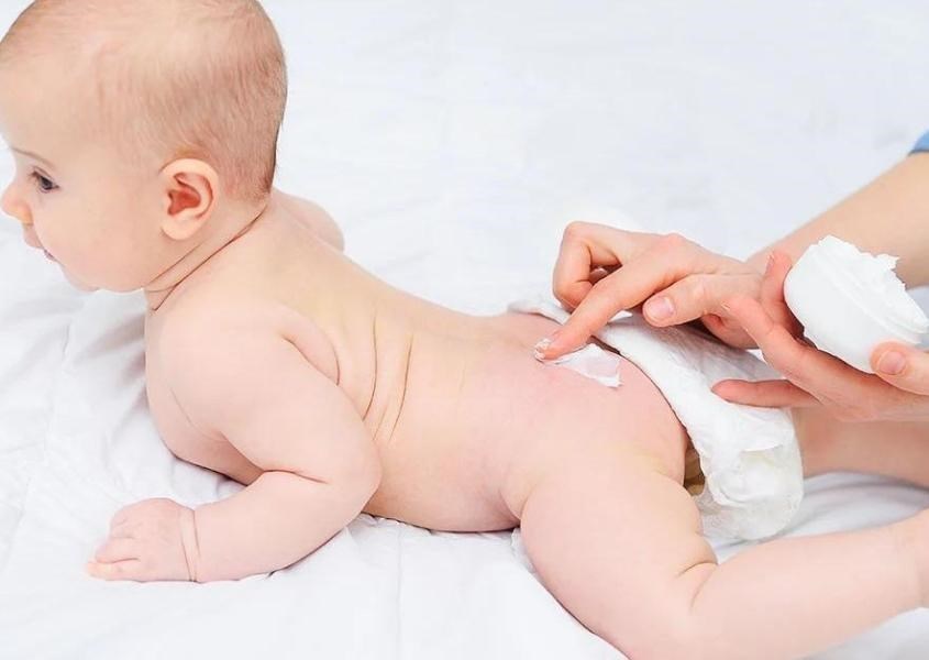 Hăm tã ở trẻ sơ sinh: Nguyên nhân và cách xử lý