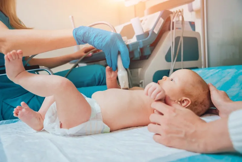 Căn bệnh nang niệu rốn ở trẻ sơ sinh: tìm hiểu về triệu chứng và phương pháp chẩn đoán