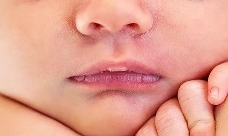 Cách xử lý tình trạng khô miệng cho trẻ - bảo vệ bé yêu khỏi những tác hại
