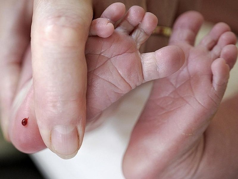 Cách thực hiện và lợi ích của xét nghiệm sàng lọc sơ sinh cho trẻ
