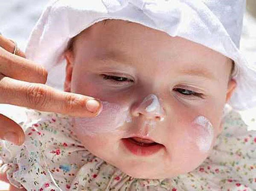 Cách trị rôm sảy cho bé “HIỆU QUẢ” “AN TOÀN” mẹ nên biết