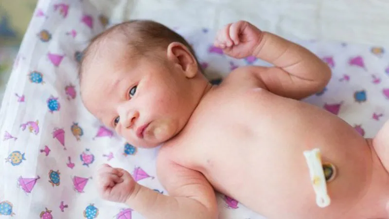 Căn bệnh nang niệu rốn ở trẻ sơ sinh: tìm hiểu về triệu chứng và phương pháp chẩn đoán