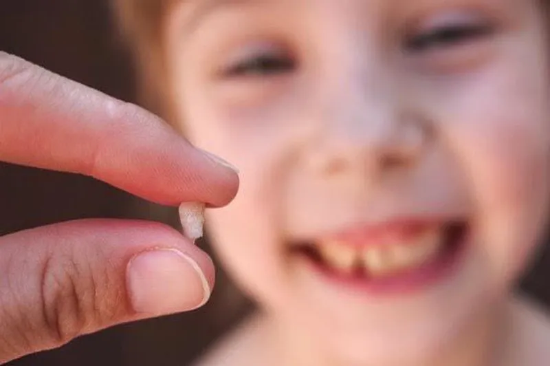 Tuổi thay răng sữa ở trẻ: điều mà các bậc cha mẹ cần biết