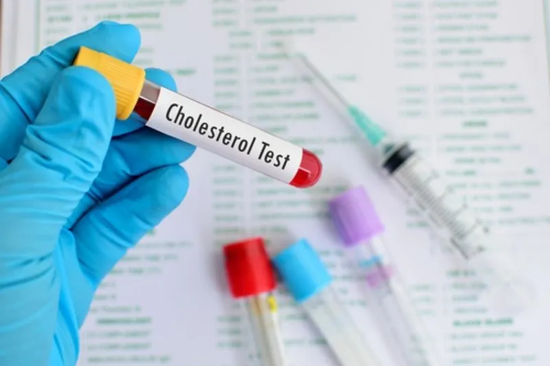 Xét nghiệm cholesterol: đo lường và dự báo nguy cơ tim mạch