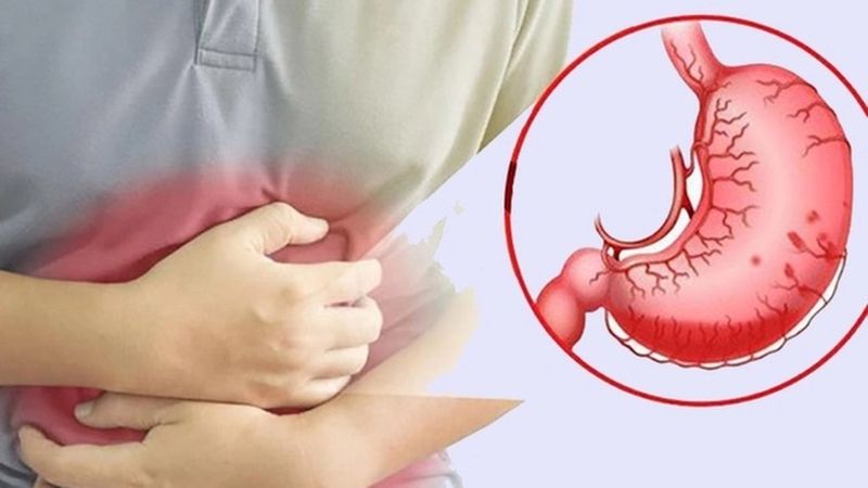 H. pylori – nguyên nhân, dấu hiệu và điều trị viêm loét dạ dày ở trẻ em