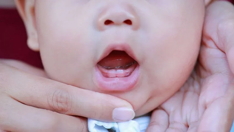 Vệ sinh răng miệng cho bé 10 tháng tuổi - bí quyết để có hàm răng chắc khỏe