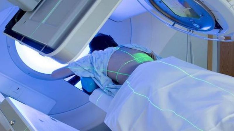 Xạ trị ung thư: tác dụng phụ và mục đích của phương pháp điều trị