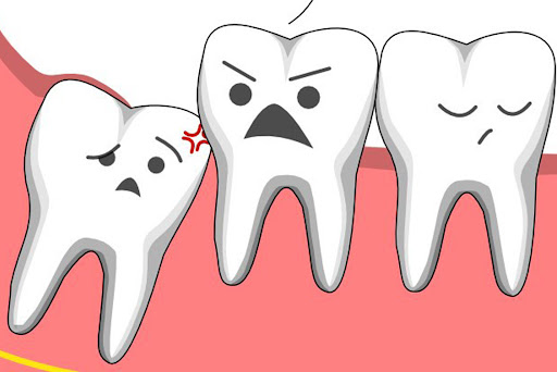 Công nghệ nhổ răng khôn mới nhất: máy siêu âm piezotome